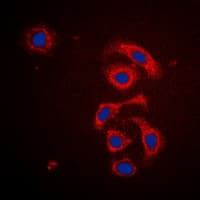 MRPS21 Antibody (Internal)