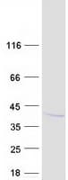 Human Myozenin / MYOZ1 Protein (Recombinant Myc-DDK (Flag))