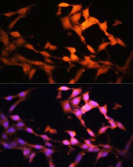 FLCN / Folliculin Antibody