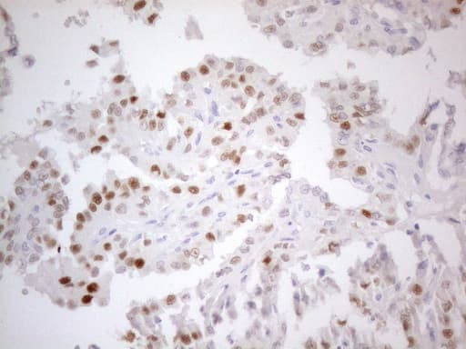CDKN1A / WAF1 / p21 Antibody (aa2-164, clone OTI4B11)