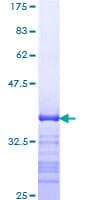 Human SMAD7 Protein (Recombinant GST, N-terminus)