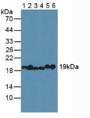 MYL2 Antibody (aa2-159)