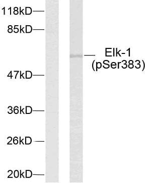 Polyclonal Rabbit anti-Human ELK1 Antibody (phospho-Ser383, IHC, WB)
