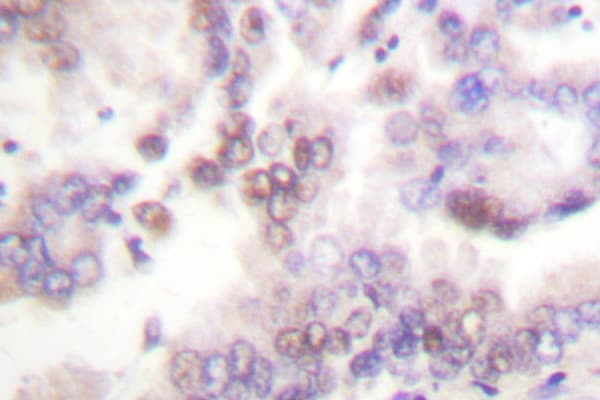Polyclonal Rabbit anti-Human CDKN2B / p15 INK4b Antibody (Gly113, IHC, IF, WB)