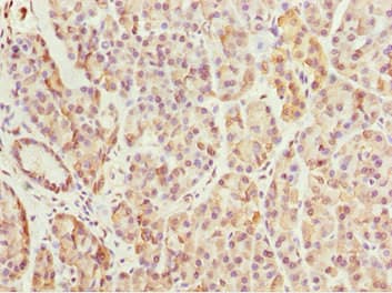 Polyclonal Rabbit anti-Human BNIP1 Antibody (IHC)