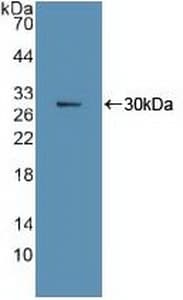 MKI67 / Ki67 Antibody (aa3088-3235, PE)