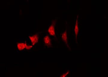 FGFR1OP / FOP Antibody