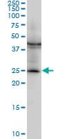 IHC-plus™ GSTM2 Antibody (clone 1E10)