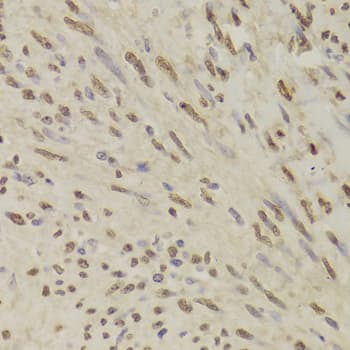 QDPR / DHPR Antibody