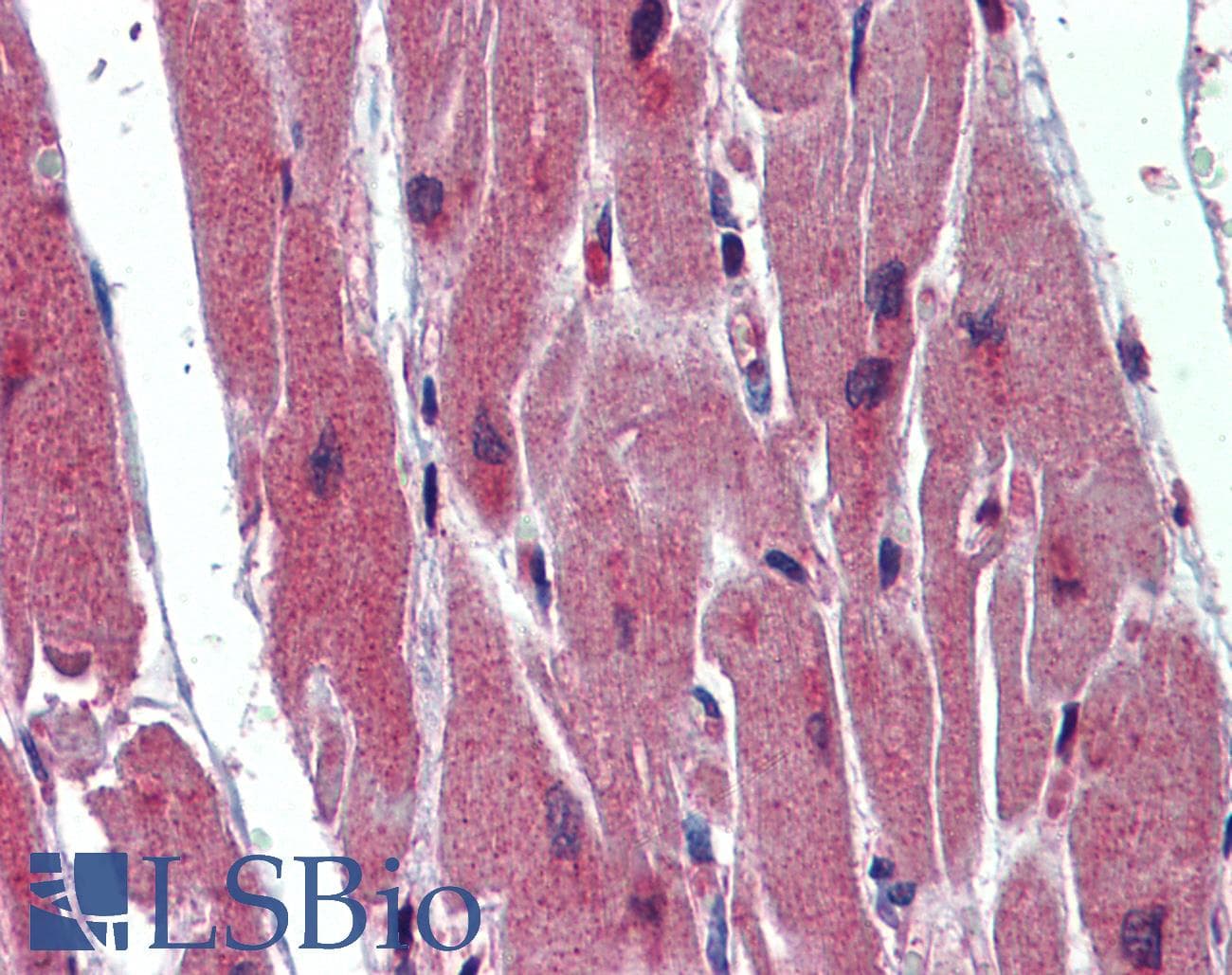 Polyclonal Rabbit anti-Human SRSF11 / SFRS11 Antibody (aa398-447, IHC, WB)
