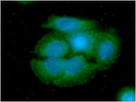 ARG2 / Arginase 2 Antibody (clone AT7F8)