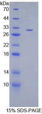 Mouse ANGPTL2 / ARP2 Protein (Recombinant His-T7)