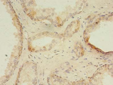 Polyclonal Rabbit anti-Human ZNF502 Antibody (IHC)