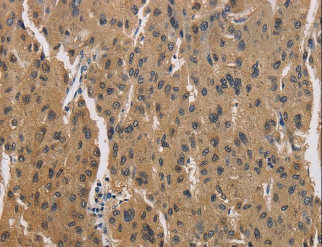 Polyclonal Rabbit anti-Human CKMT2 Antibody (IHC, WB)