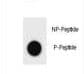 Hamartin / TSC1 Antibody (phospho-Ser555)