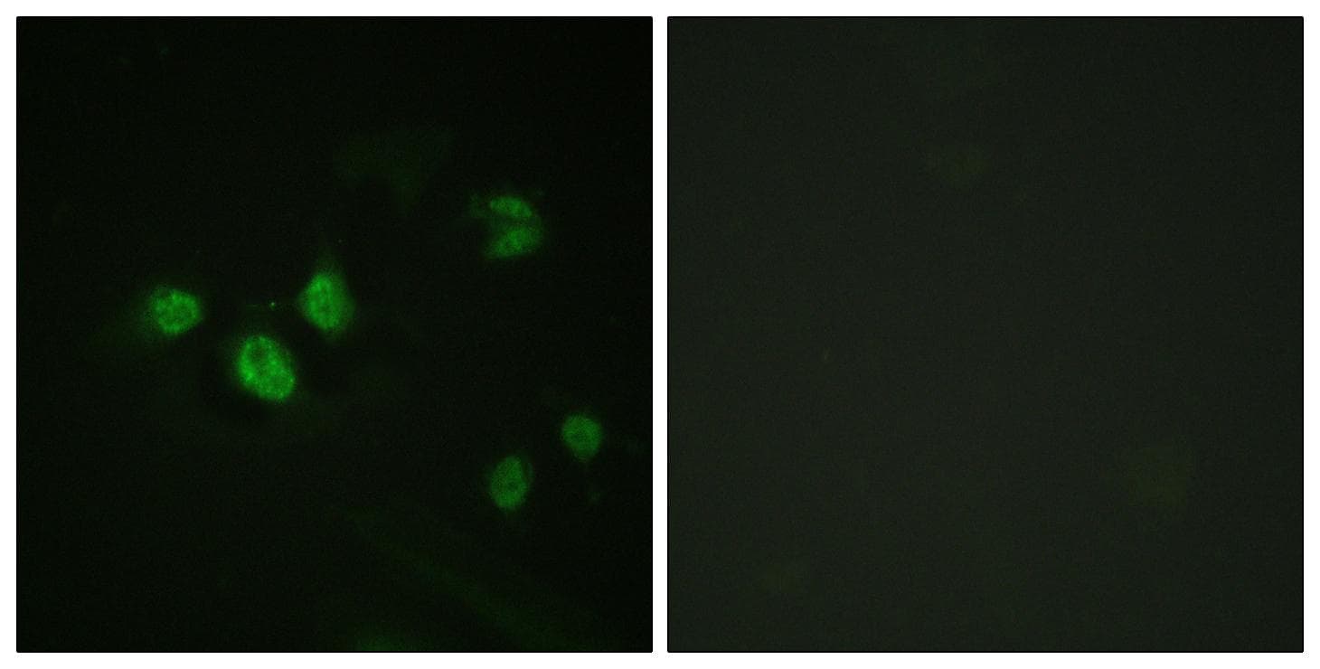 SP1 Antibody (phospho-Thr453)