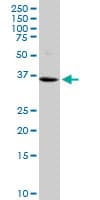 IHC-plus™ Vasohibin 1 / VASH1 Antibody (clone 4A3)