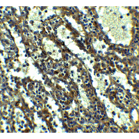 Polyclonal Rabbit anti-Human QSOX1 / QSCN6 Antibody (IHC, IF, WB)