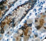 MUC5AC Antibody (clone CLH2, Ready-to-Use)