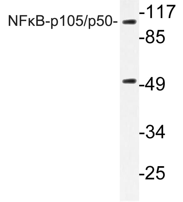Polyclonal Rabbit anti-Human NFKB1 / NF-Kappa-B Antibody (Asp926, IHC, WB)