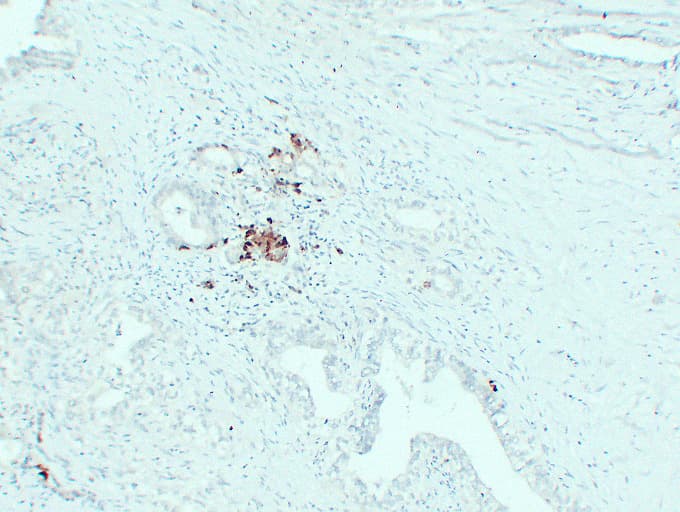 IGF2 Antibody (clone ABT-IGF2)
