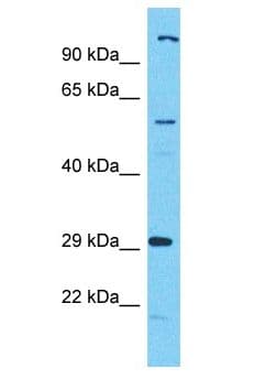 Polyclonal Rabbit anti-Human C17orf99 Antibody (aa59-108, WB)