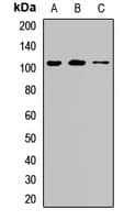 Polyclonal Rabbit anti-Human KIAA1524 / p90 Autoantigen Antibody (WB)