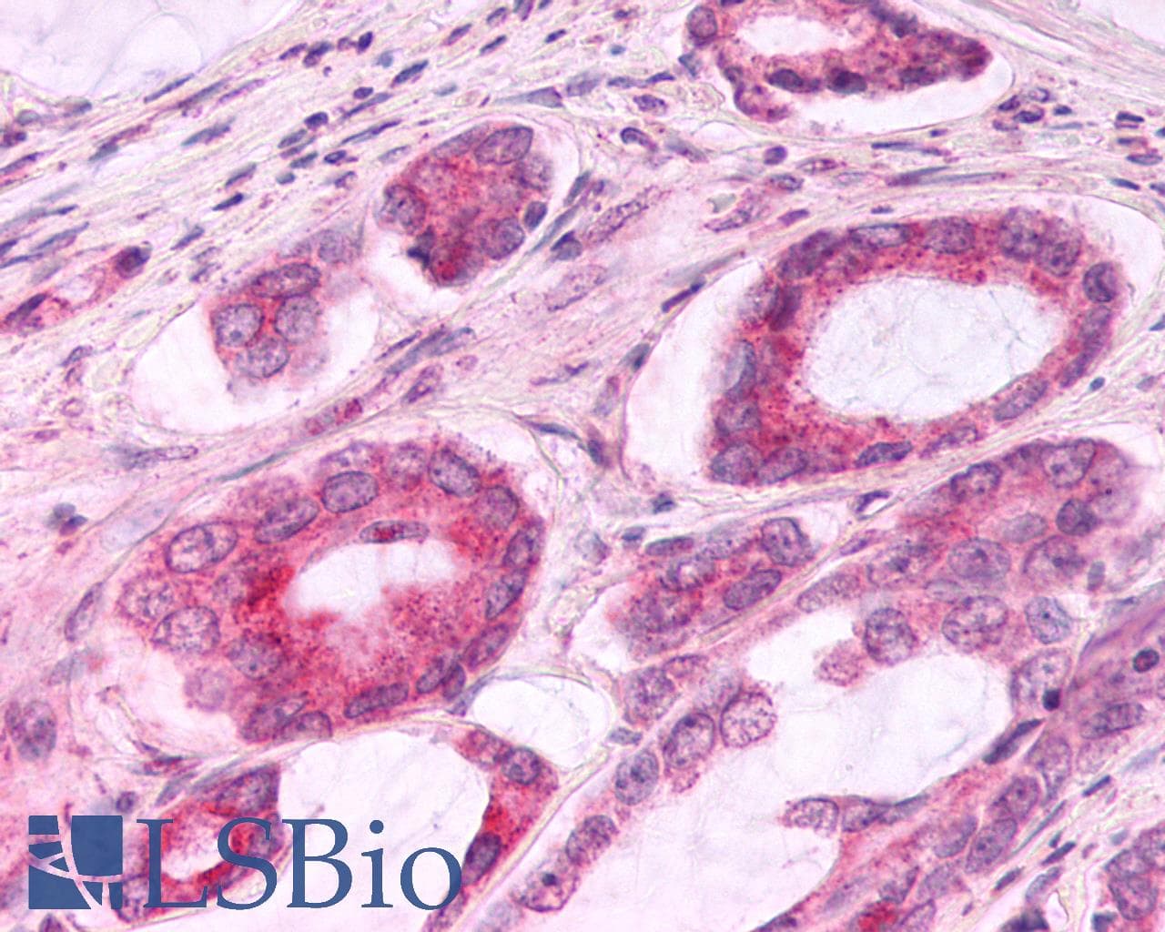 PathPlus™ CCR3 Antibody (C-Terminus)