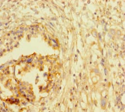 Polyclonal Rabbit anti-Human ATRX Antibody (IHC, IF)