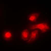 STK11 / LKB1 Antibody (C-Terminus)