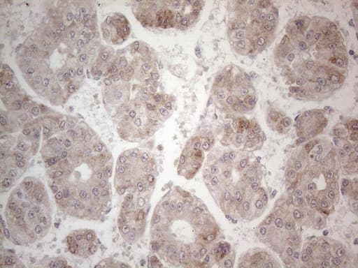 Monoclonal Mouse anti-Human PD-L2 / PDCD1LG2 / CD273 Antibody (clone OTI5E5, IHC, WB)