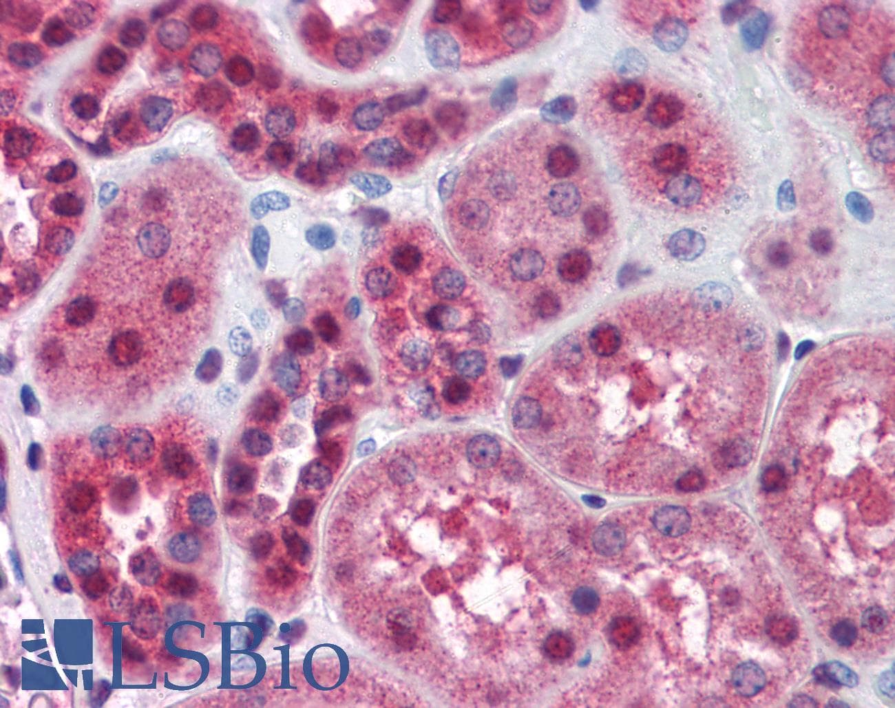 IHC-plus™ FKBP4 / FKBP52 Antibody (aa433-447)