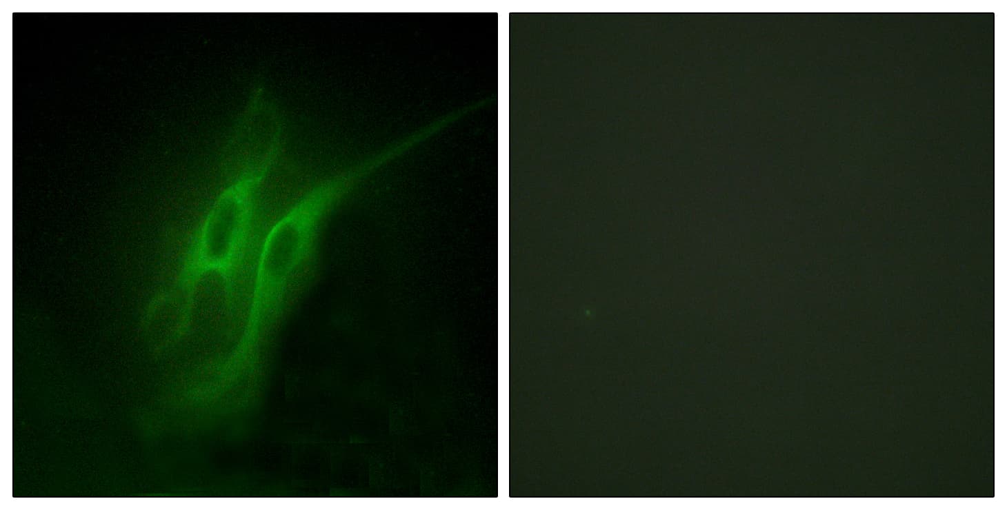 HTR4 / 5-HT4 Receptor Antibody (aa21-70)