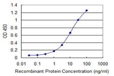 IHC-plus™ Monoclonal Mouse anti-Human CORO1C Antibody (clone 1F7, IHC, WB)