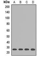 GSTK1 Antibody