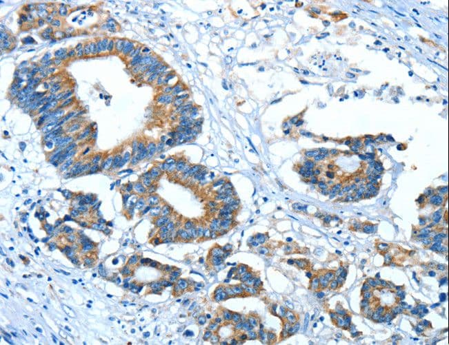 GLRA1/Glycine Receptor Alpha 1 Antibody