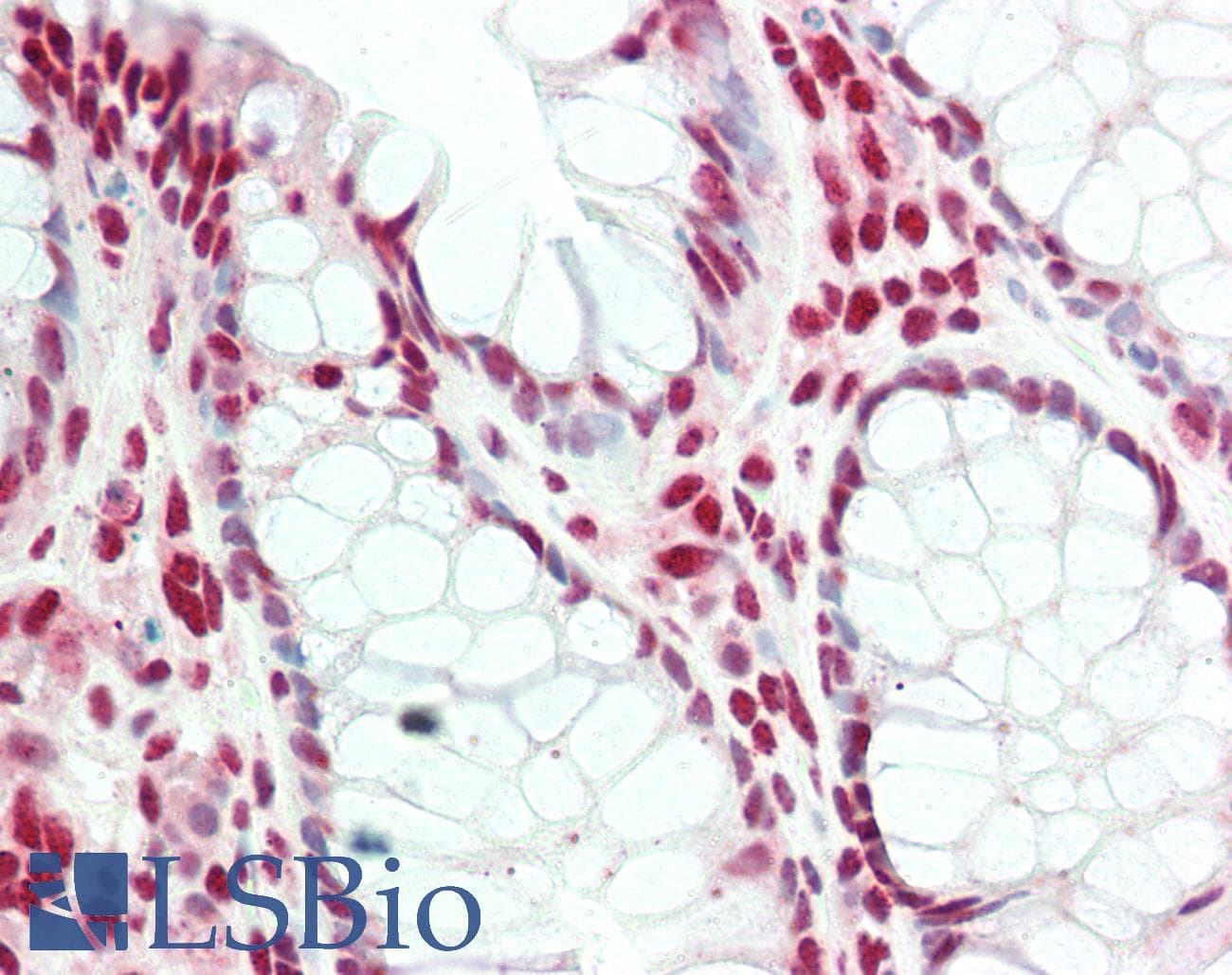 IHC-plus™ BLIMP1 / PRDM1 Antibody (C-Terminus)