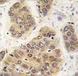 Polyclonal Rabbit anti-Human SUMO4 Antibody (aa34-63, IHC, WB)