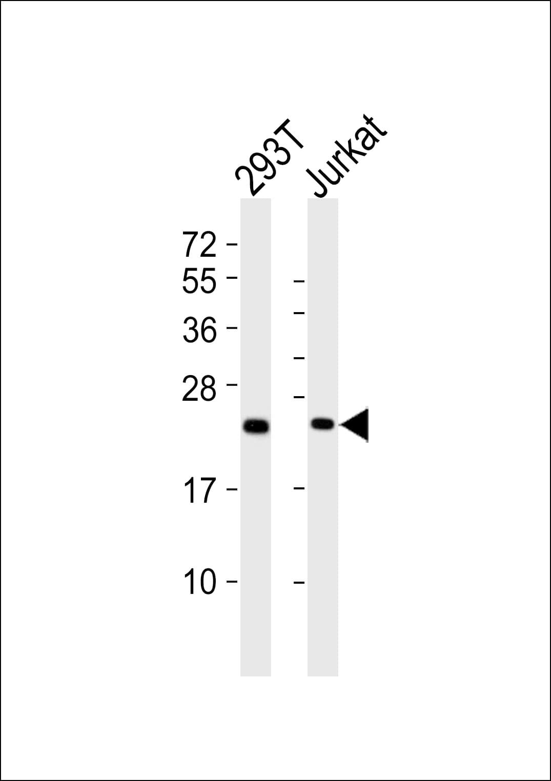 RPS9 / Ribosomal Protein S9 Antibody