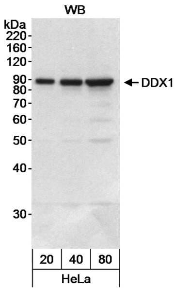 IHC-plus™ Polyclonal Rabbit anti-Human DDX1 Antibody (aa500-550, IHC, WB)
