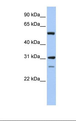 Polyclonal Rabbit anti-Human IMPDH1 Antibody (aa254-303, IHC, WB)