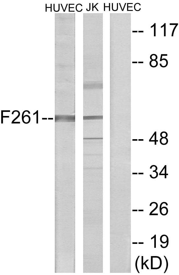 PFKFB1 Antibody