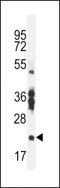 RBPMS2 Antibody (aa113-141)