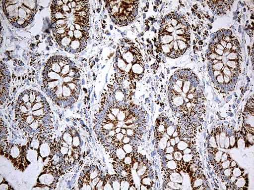 MCAD / ACADM Antibody (clone OTI10A5, Carrier-free)