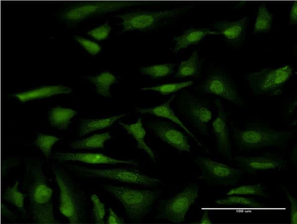 IHC-plus™ ATP6E / ATP6V1E1 Antibody (clone 4E11)
