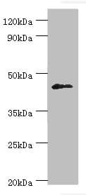 Polyclonal Rabbit anti-Human DUSP7 Antibody (aa160-419, IHC, WB)