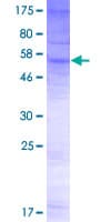 Human SLC51A / OSTalpha Protein (Recombinant GST)