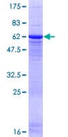Human PP2Ac / PPP2CA Protein (Recombinant GST)