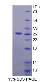 Mouse MMRN2 / Emilin 3 / EndoGlyx-1 Protein (Recombinant His-T7)
