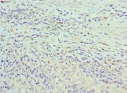 Polyclonal Rabbit anti-Human ASF1A Antibody (aa1-204, IHC, WB)